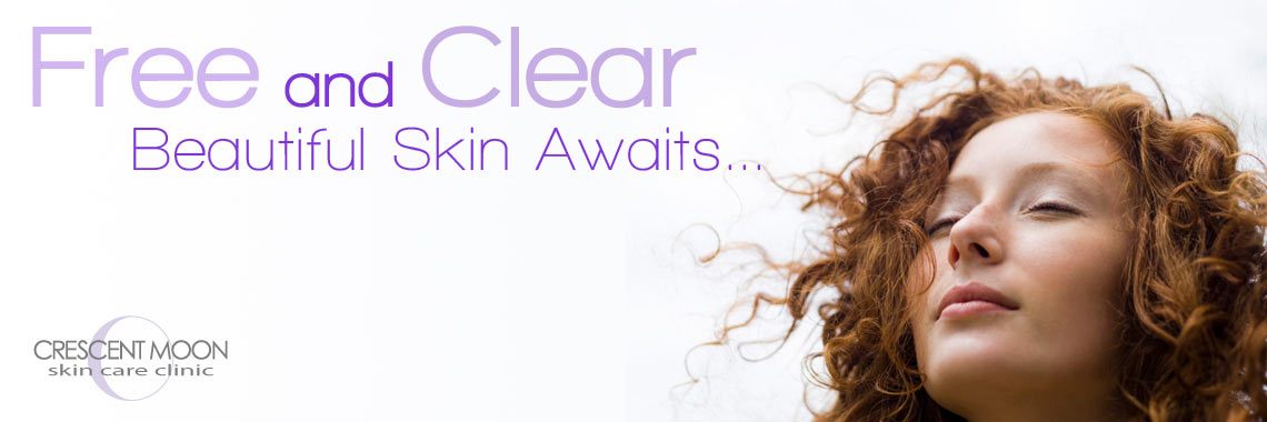 Crescent Moon Skin Care Clinic can help you achieve acne-free skin